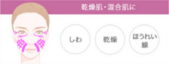しわ ほうれい線 乾燥