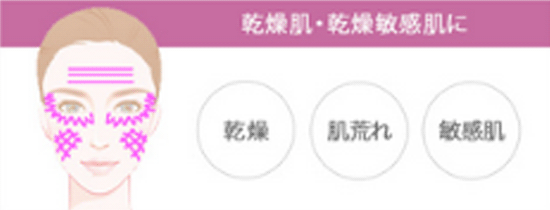 乾燥 肌荒れ 敏感肌